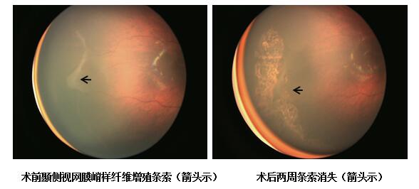 QQ截图20180413110841.jpg